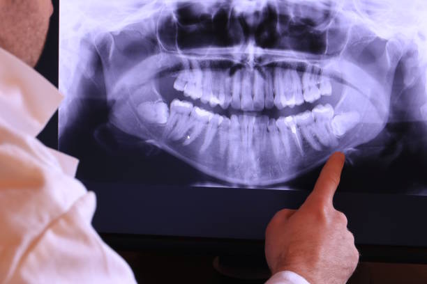 Best Emergency Dental Services for Seniors in Shannon Hills, AR