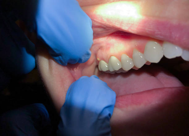 Best Broken or Cracked Tooth Emergency Dentist in Shannon Hills, AR