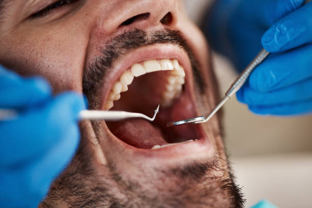 Best Emergency Dentist for Lost Fillings or Crowns in Shannon Hills, AR